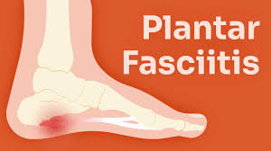 Image result for Foot Pain