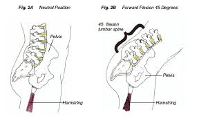 Prostate cancer programme of muscles, fascia, ligaments, blood vessels, organs and nerves. Low Back Pain Dubin Chiropractic