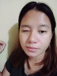 Would you rather have to 🍑 to itch uncontrollably 24/7 or would you rather  have an infected stye