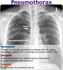 Pin By Heather Demassa On Rosh Reviews All Radiology Imaging Emergency Nursing Respiratory Care