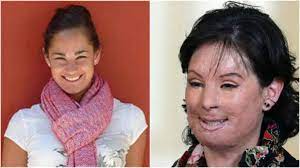 Selecciona los cuidadores disponibles en méxico. Este Era El Conmovedor Sueno De Natalia Ponce De Leon Antes De Ser Atacada Con Acido Que Ahora Ya No Podra Cumplir Tkm Colombia
