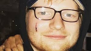 Ed Sheeran's Princess Beatrice sword cut story is a lie, James Blunt says