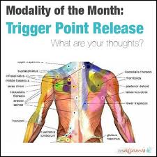 Shoulder Trigger Points Chart Www Bedowntowndaytona Com