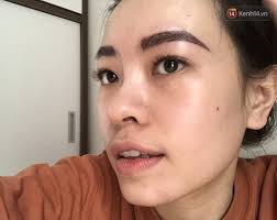Tâm sự của cô gái theo trend không dùng sữa rữa mặt kết quả mụn mọc đầy mặt 