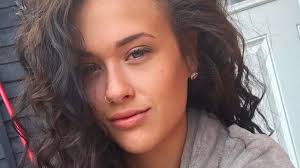 Mum who lost hair in her 20s desperate for return of in-person doctor  appointments