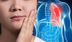 Most people with lung cancer don't have symptoms until the cancer is advanced. Lung Cancer Symptoms Signs Of Advanced Stages Include Superior Vena Cava Obstruction Express Co Uk