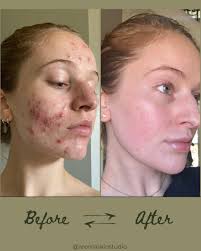 Part time esthetician job in east Nashville available