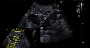 Check spelling or type a new query. Instruments Archive Endoscopy Campus