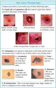 Learn more about targeted therapy, surgery, and chemotherapy. Skincancer