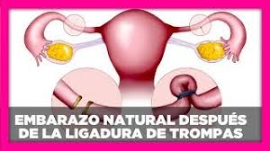 Embarazo Natural Despues De La Ligadura Dra Katy Villa Youtube