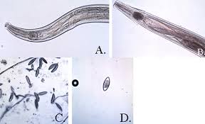 Image result for Pinworm