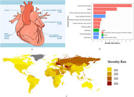 Maybe you would like to learn more about one of these? Machine Learning Based Coronary Artery Disease Diagnosis A Comprehensive Review Sciencedirect