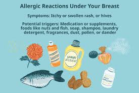 Image result for heat rash under breasts