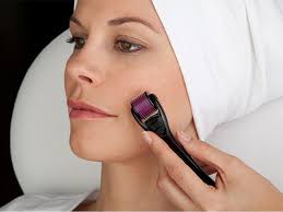 Có nên kết hợp lăn kim và peel da để trị sẹo sau mụn không?