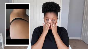 What causes the dowager's hump in downton abbey? I Have Dowager S Hump Youtube