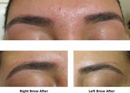 Tattooed eyebrows, these days, are done in the epidermal or very top layer of the skin unlike actual regular tattooing where ink is deposited into the dermal layer. When Not To Tattoo Your Eyebrows With Permanent Makeup