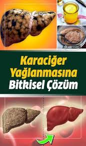 karaciger yaglanmasi neden olur nasil temizlenir bitkisel tedavisi hastalik belirtileri 2020 saglikli iliskiler saglikli dogal saglik