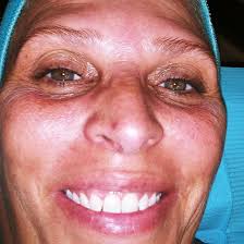 STELO(@steloskincare) • Instagram 사진 및 동영상