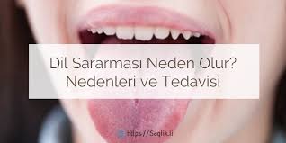 Dil Sararmasi Neden Olur Dilde Sarilik Nedenleri Tedavisi Nasil Gecer