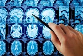 A radiologist produces a diagnosis of a patient from medical images. Should I Go Into Radiology A Radiologist Gives Honest Answers