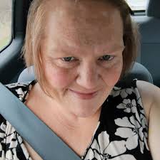 What are the pros and cons of gastric sleeve surgery?