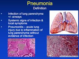 The alveoli are held open by the transpulmonary pressure, or prestress, which is balanced by tissues forces and alveolar surface film forces. Pulmonary Infections Pneumonia Flashcards Quizlet