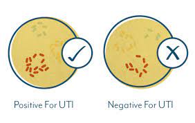 When those muscles are too tight or they spasm, women can experience a series. Why Your Uti Test May Be Negative Even If You Have Symptoms
