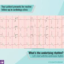 Our online cardiology trivia quizzes can be adapted to suit your requirements for taking some of the top cardiology quizzes. Routine Follow Up In Cardiology Clinic What S The Underlying Rhythm Core Im Podcast