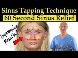 Dr Mandell S Sinus Tapping Technique 60 Second Sinus Drainage Relief Headaches Tinnitus Youtu Sinus Drainage Natural Headache Remedies Tinnitus Remedies