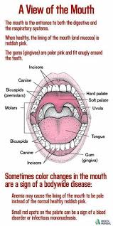 When Healthy The Lining Of The Mouth Oral Mucosa Is Reddish Pink Sometimes Color Changes In The Mouth Are A Sign Of A Bodyw Oral Care Oral Oral Health Care