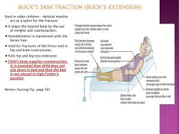 What is prior to boot placement, after. The Child With A Musculoskeletal Condition Ppt Download
