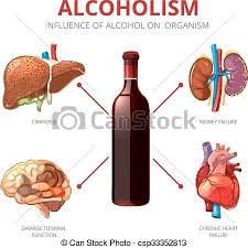 Resultado de imagen para alcoholismo