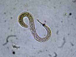 Nematodes translucent small clear worm. Is A Skin Penetrating Nematode Searching For You Bugbitten