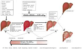 Pentru analizele ce au rolul de a depista hepatita c nu este necesara nicio pregatire a organismului (de pilda, postitul) in vederea recoltarii. Ce Analize Se Fac Ca Sa Afli Daca Ai Hepatita C Cabinet Gastroenterologie Si Boli De Ficat In Bucuresti