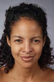 When left untreated, the toxin reaches the respiratory muscles resulting in lung failure. Botulinum Toxin Injections In Plastic Surgery Overview Botulinum Toxin Cosmetic Use For The Face