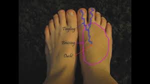 There can be other, less obvious causes, however. Top Of The Foot Pain Relief Home Treatment Remedies Causes Youtube
