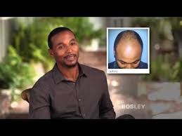 4.0 out of 5 stars 622. Bosley Revive For Coloured Visibly Thinning Hair Nourishing Shampoo Hairhouse Warehouse