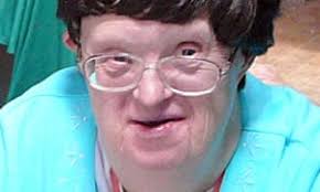 Other lives + Down's syndrome