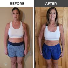 Salt Lake City Weight Loss Clinic - Salt Lake City Fat Loss