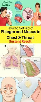 How To Get Rid Of Phlegm And Mucus In Chest Throat Instant Result Magical Useful Tips Getting Rid Of Phlegm Mucus Getting Rid Of Mucus