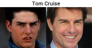 7 Makeovers dentales de celebridadesDental Clinic