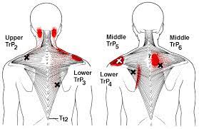 The upper back is designed to protect the organs in your chest and anchor the rib cage. Pin On Natural Pain Relief