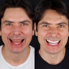 Rafael Cabello (@dr.rafacabello) • Instagram photos and videos