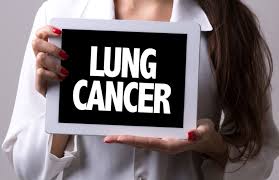Signs and symptoms of lung cancer are not always present until the disease advances. Lung Cancer What Causes Lung Cancer In Non Smokers Risk Factors Warning Signs And Preventive Steps Health Tips And News