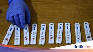Seputar Rapid Test Covid Cara Kerja Hingga Harga Jualnya