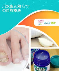 爪水虫に効く7つの自然療法 みんな健康 爪水虫 自然療法 ヴェポラップ
