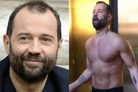 L'attore comico ha ricevuto un trattamento per il trapianto di capelli. Fabio Volo Ha Risolto Il Problema Dei Capelli Stefano Rogora