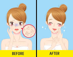 Kết quả hình ảnh cho uống nước dừa có tác dụng gì