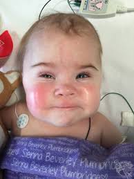 Brave Toddler Afflicted With Life Threatening Tumours Defies Doctors To  Speak To Her Doting Mother