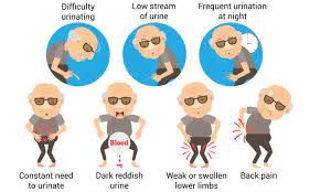 How to diagnose for prostate cancer? Understanding Prostate Cancer Health Plus